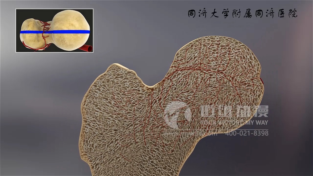 醫(yī)學(xué)三維動(dòng)畫 醫(yī)學(xué)三維動(dòng)畫