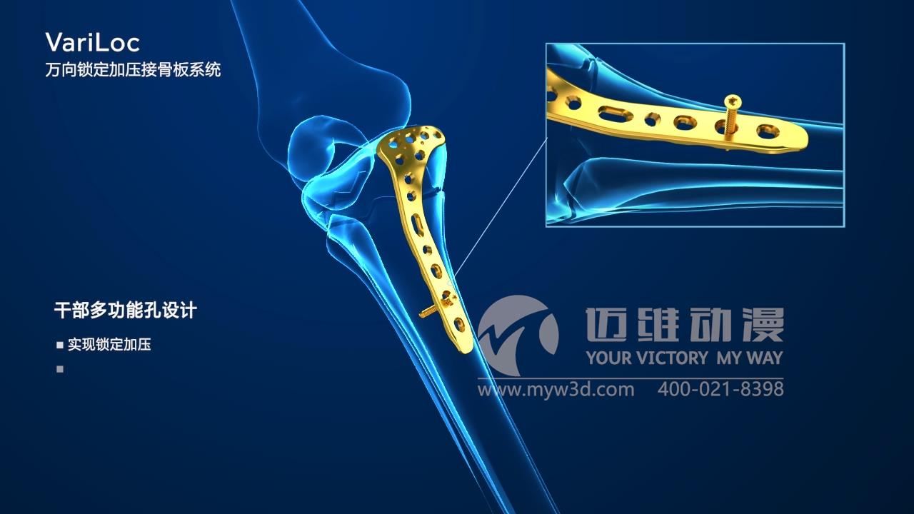 醫(yī)療器械三維動畫.jpg 醫(yī)療器械三維動畫.jpg