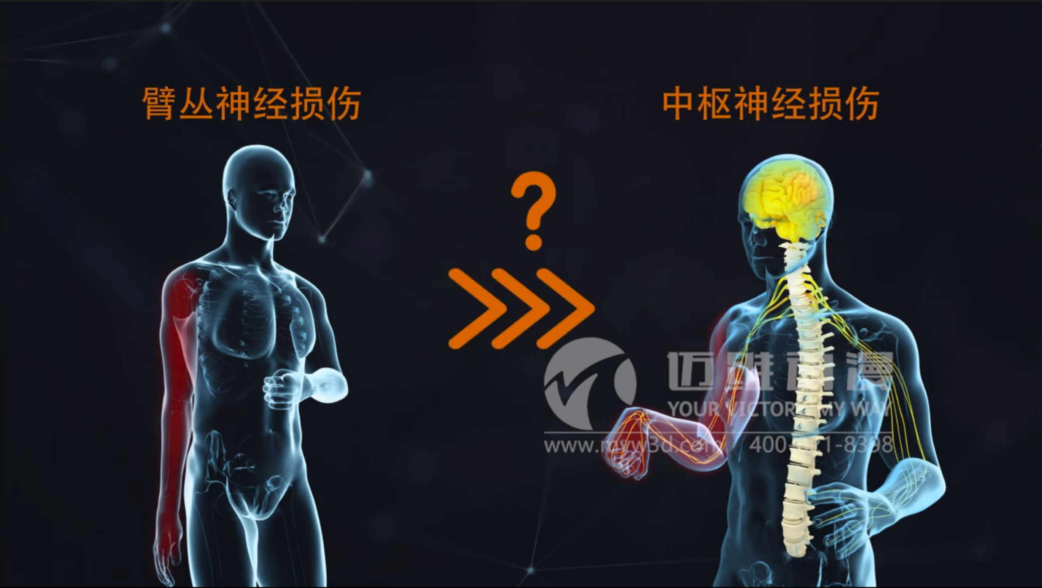 三維動(dòng)畫(huà)對(duì)醫(yī)療行業(yè)的影響(圖1) 三維動(dòng)畫(huà)對(duì)醫(yī)療行業(yè)的影響(圖1)