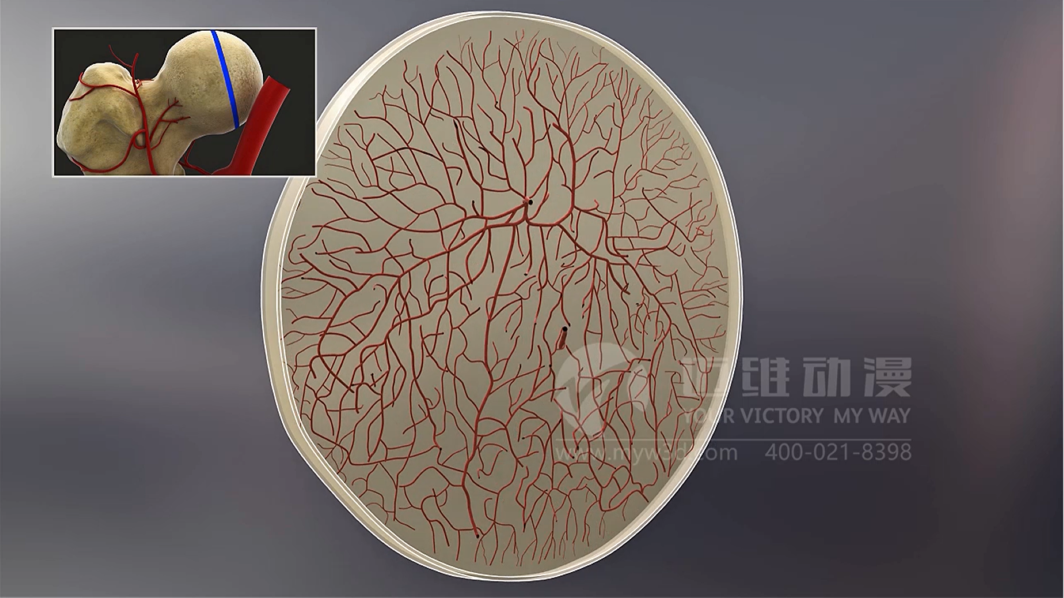 三維動(dòng)畫(huà)對(duì)醫(yī)療行業(yè)的影響(圖3) 三維動(dòng)畫(huà)對(duì)醫(yī)療行業(yè)的影響(圖3)