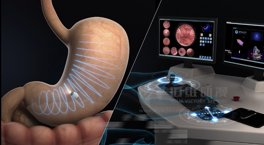 醫(yī)用設(shè)備三維動(dòng)畫(huà)制作好處有哪些？(圖3)
