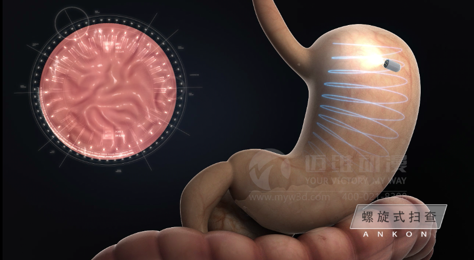 醫(yī)用設(shè)備三維動(dòng)畫(huà)制作好處有哪些？(圖2)