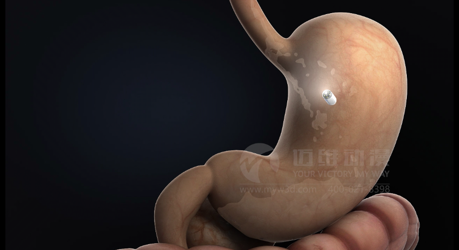 醫(yī)用設(shè)備三維動(dòng)畫(huà)制作好處有哪些？(圖1)