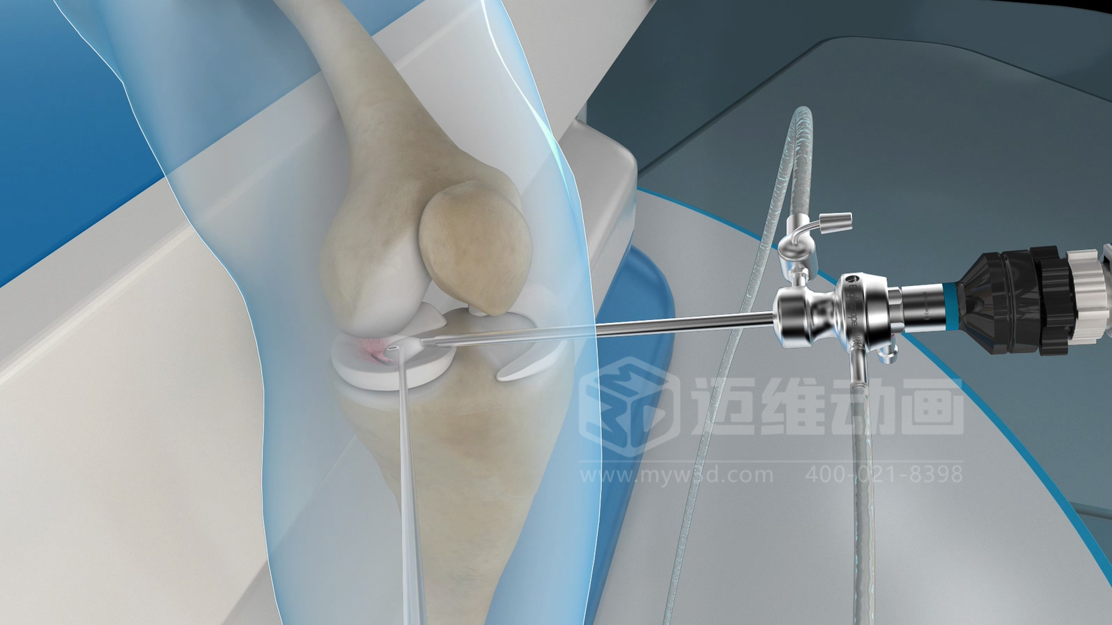 醫(yī)學(xué)手術(shù)三維動(dòng)畫(huà)制作公司哪家好？解碼上海邁維動(dòng)漫的醫(yī)學(xué)醫(yī)療3D可視化創(chuàng)新之路(圖1)