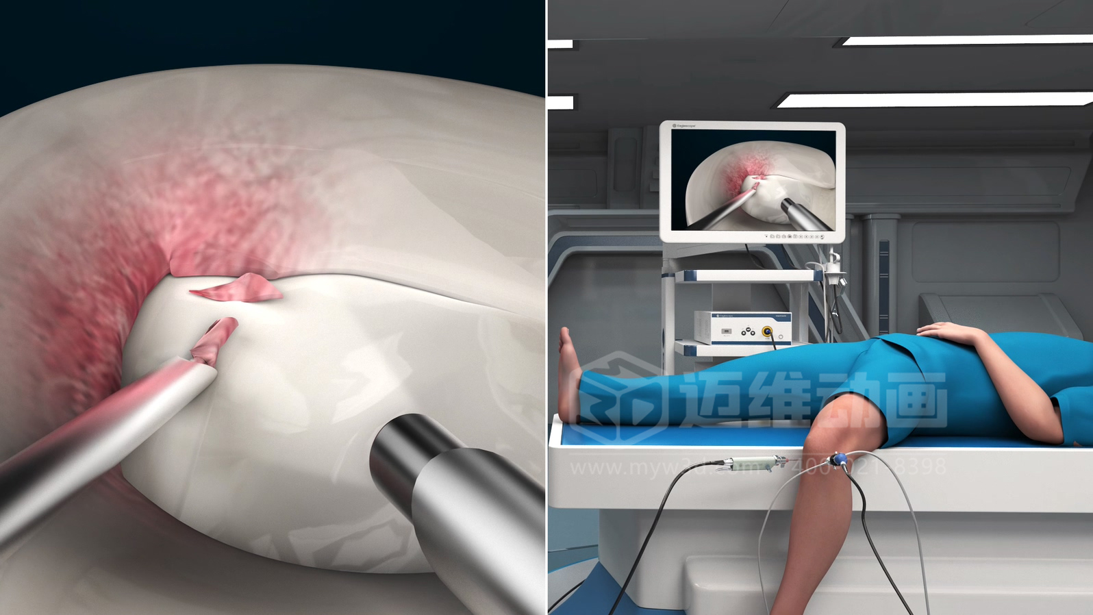 醫(yī)學(xué)手術(shù)三維動(dòng)畫(huà)制作公司哪家好？解碼上海邁維動(dòng)漫的醫(yī)學(xué)醫(yī)療3D可視化創(chuàng)新之路(圖2)
