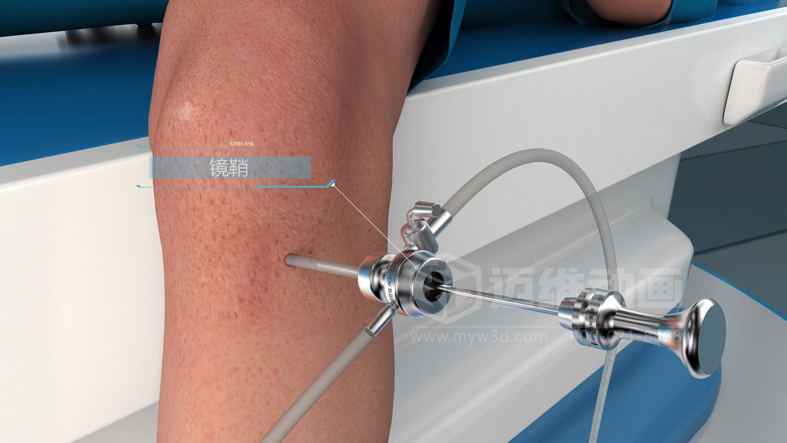 醫(yī)學(xué)手術(shù)三維動(dòng)畫(huà)制作公司哪家好？解碼上海邁維動(dòng)漫的醫(yī)學(xué)醫(yī)療3D可視化創(chuàng)新之路(圖2)